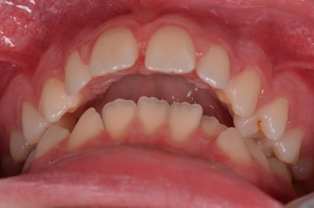 ????????????????????????????????????