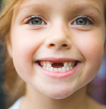 Sindromul copilului știrb și părintelui disperat sau de ce nu ies dinții permanenți miruna ioani