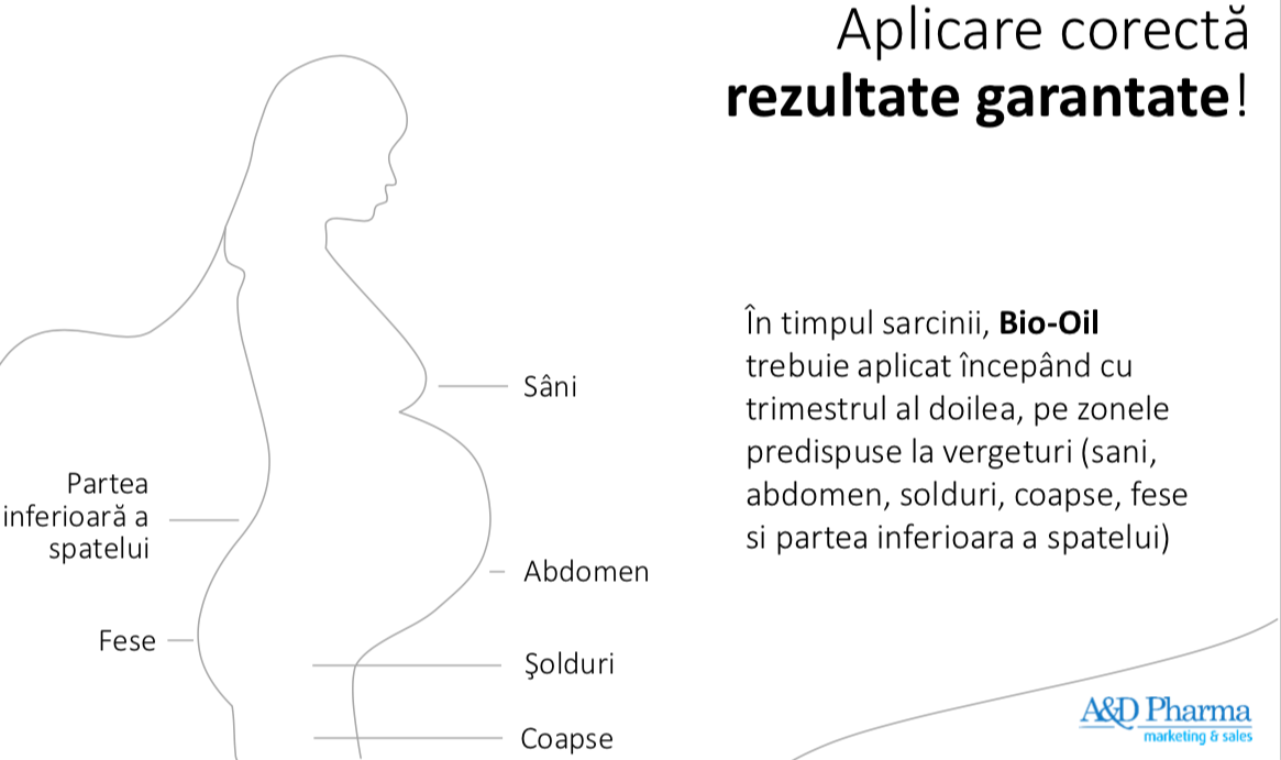 etapa inițială varicoasă în timpul sarcinii)